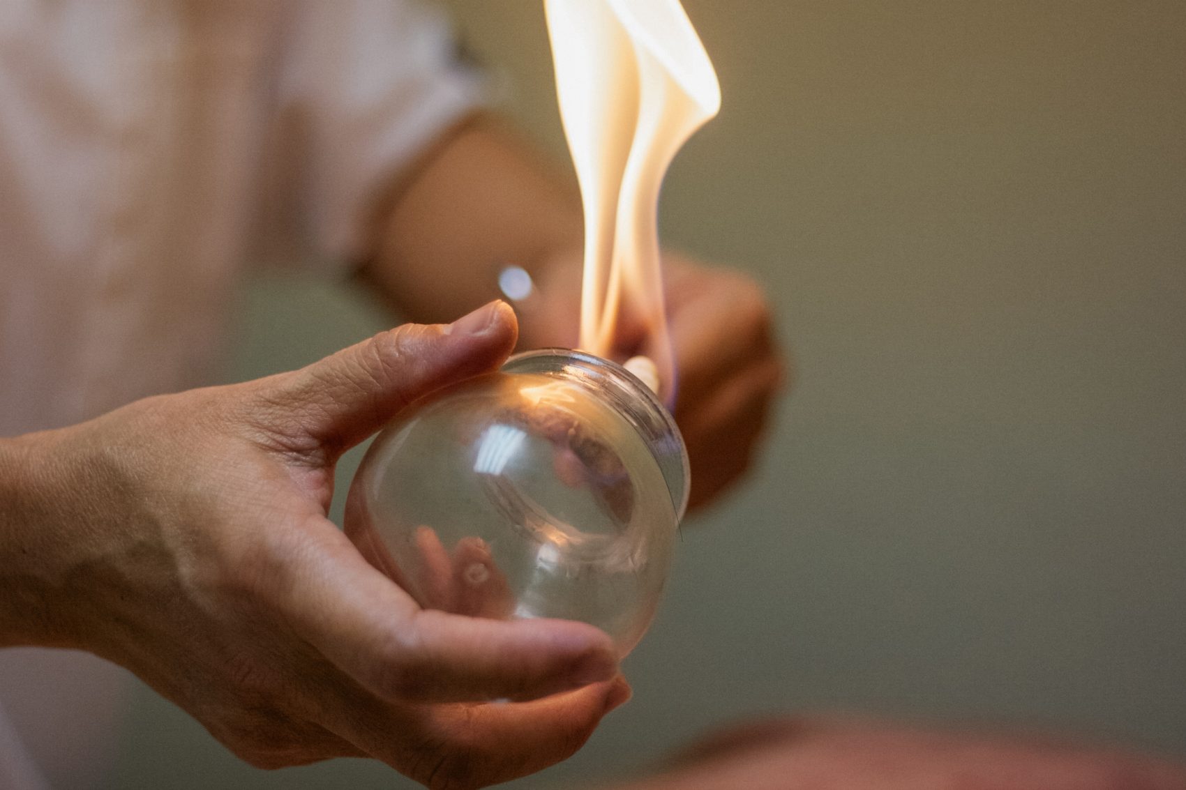 Masseuse lighting a fire in a cupping apparatus